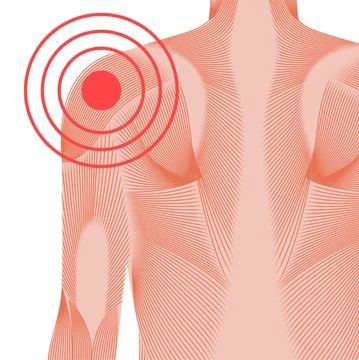 Shoulder pain concept Stock Illustration
