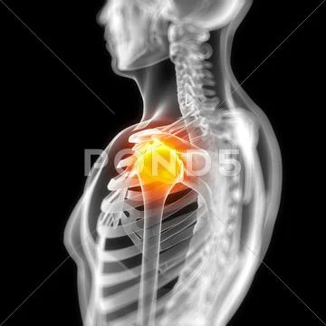 Shoulder pain, conceptual artwork Stock Illustration