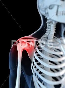 Shoulder pain, conceptual artwork Stock Illustration