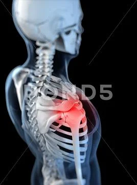 Shoulder pain, conceptual artwork Stock Illustration