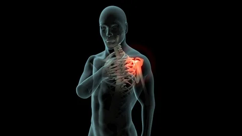 Shoulder Pain Stock Footage 121788889