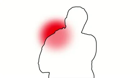 Shoulder Pain Man Silhouette Stock Footage