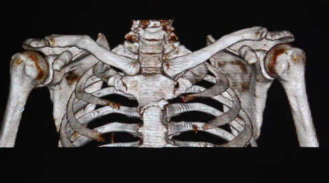 Shoulder  x-rays 3d image Stock Footage 26365146