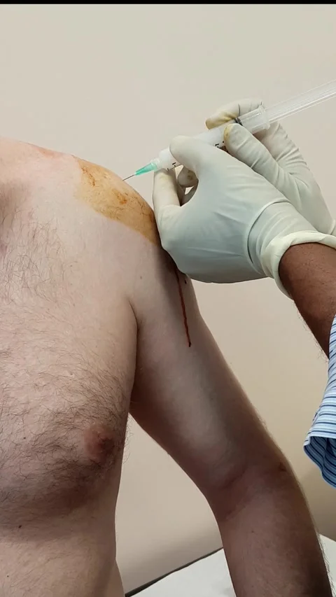 ShoulderInjection Stock Footage 330816761