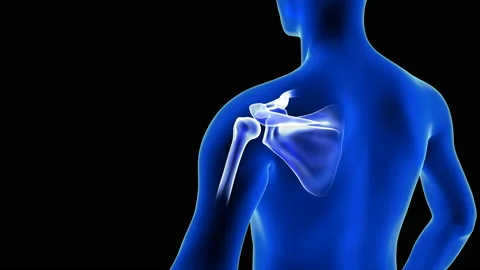 Shoulders Pain close-up animation from b... | Stock Video | Pond5