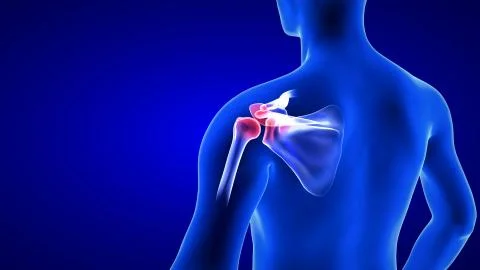 Shoulders Pain close-up illustration - back view. Blue Human Anatomy Body 3D Stock Illustration
