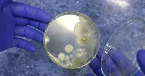 Show the mold colonies Stock Footage 309444179