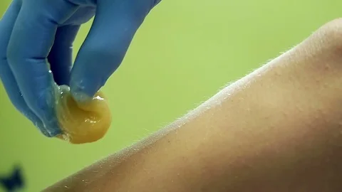 Shugaring master applies sugar paste on teh feet of client Stock Footage 79603458