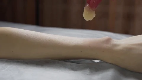 Shugaring procedure. 100 frames Stock Footage 124498730