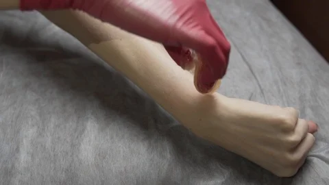 Shugaring procedure. in slow motion Stock Footage 124498762