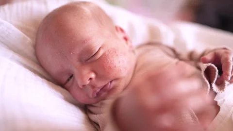 sick baby newborn with hospital a Stock Video Pond5