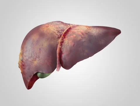Sick human liver with cancer Stock Illustration