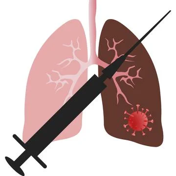 Sick human lungs with a syringe. Vector image. Stock Illustration