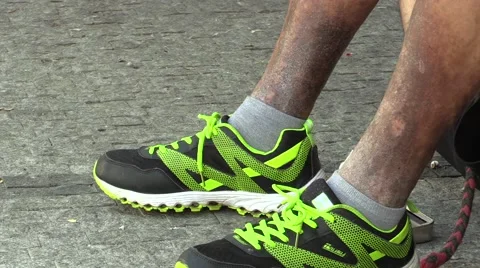 Sick legs homeless Stock Footage 55263379