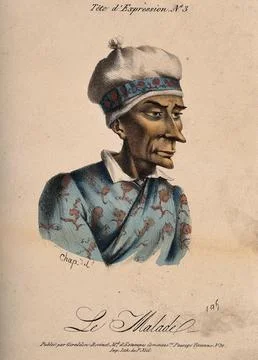 A sick man. Coloured lithograph by Chap (?). Stock Illustration