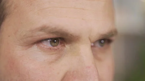 Sick man.Close up of man with eye twitch. 库存影片 218632137