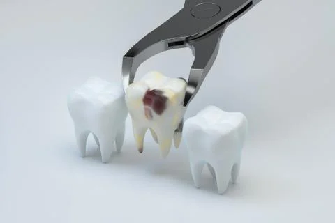 The sick tooth being pulled out, 3d rendering. Stock Illustration