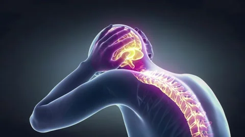 Sick woman with pain, headache, migraine, stress, insomnia, hangover in hand  Stock Footage