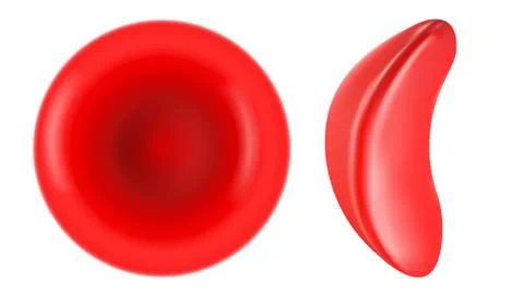 Sickle cell and normal red blood cell illustration Stock Illustration