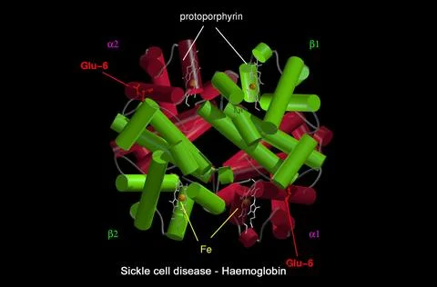 Sickle cell disease - mol. model haemoglobin Stock Illustration