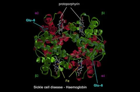 Sickle cell disease - mol. model haemoglobin Stock Illustration