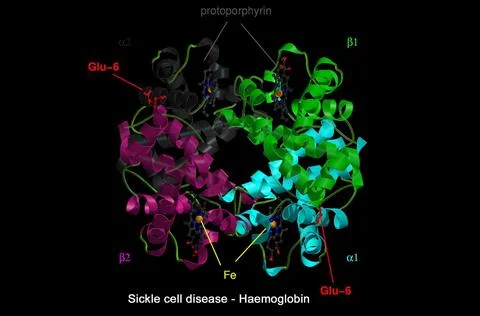 Sickle cell disease - mol. model haemoglobin Stock Illustration