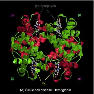 Sickle cell disease - mol. model haemoglobin Stock Illustration