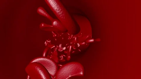 Sickle cell disease move inside blood vessel artery vein Stock Footage 304885322