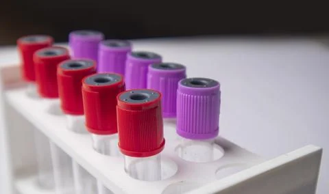 A side-angle, close-up shot of multiple medical blood collection tubes with.. Stock Photos