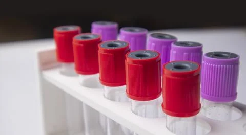 A side-angle, close-up shot of several medical blood collection tubes with .. Stock Photos
