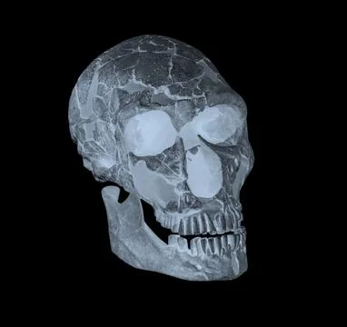 Side face skull x-ray image Stock Photos