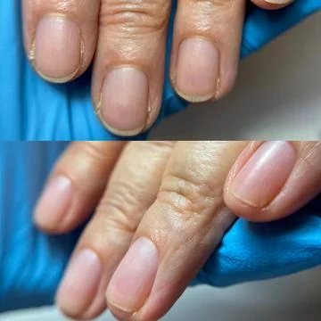 Side by side comparison of natural nails before and after a hygienic manicure Foto stock