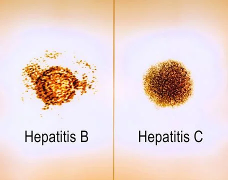  Side-by-side transmission electron micrograph images of hepatitis B and C... Stock Photos