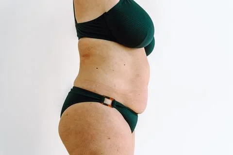 Side view body middle-aged woman with sagging belly, age spots Stock Photos