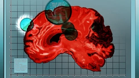 Side view cross section of a brain MRI RED Stock Footage 94878730