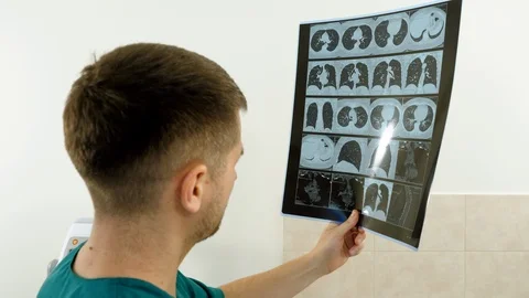Side view of doctor looking at x-ray image in office. 4K 库存影片 122433146