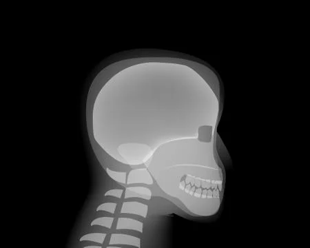 Side view Human head skull on x-ray film Stock Illustration