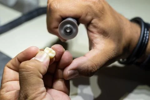 Side view of a pair of hands polishing a tooth. Stock Photos