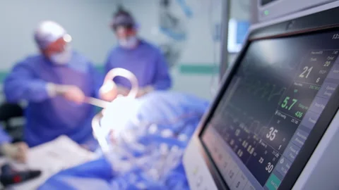 Side view on the screen of lung ventilator with life parameters. Team of Stock Footage 331081623