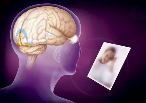  Sight Visual cortex. Illustration of the visual zones of the brain, on a ... Stock Photos