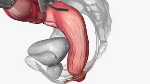 sigmoid colon is the terminal portion of... | Stock Video | Pond5