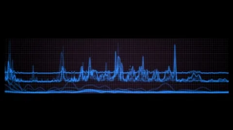 Signal analysis Stock Footage 46513285