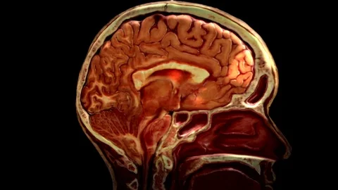 Signals to the Brain Stock Footage 90866877