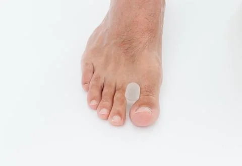 Silicone toe separator for bunion toe or hallux valgus. Stock-Fotos