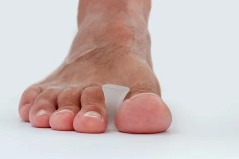 Silicone toe separator for bunion toe or hallux valgus. 库存照片