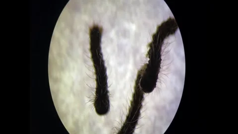 Silkworm eggs and hatchlings shot on a Digital Microscope in India. Stock Footage 279047229