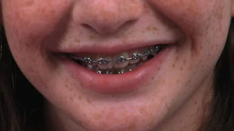 Silver Smile by Eva-Lution Studios - 434 Video stock 12179529