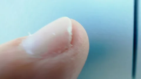 Simple case of a broken nail that needs to be trimmed Stock-Footage 206528830