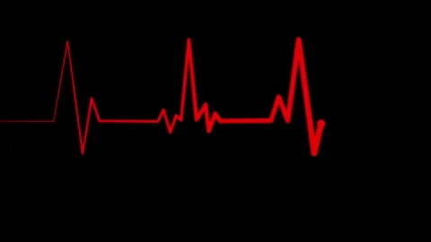 Simple Electrocardiogram Animation, Animated Heart Rhythm Line Stock Footage 309965905