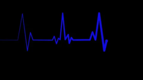 Simple Electrocardiogram Animation, Anim... | Stock Video | Pond5